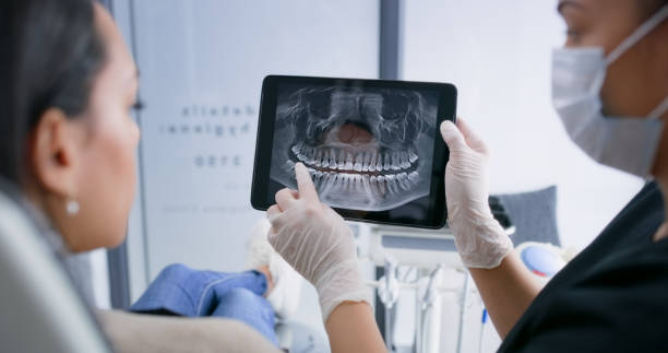 Licensed Wisdom Tooth Removal service in Southport, IN - Smile Center Dentistry